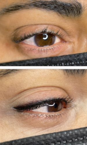 eyeliner marianna lamanna derma specialist a4